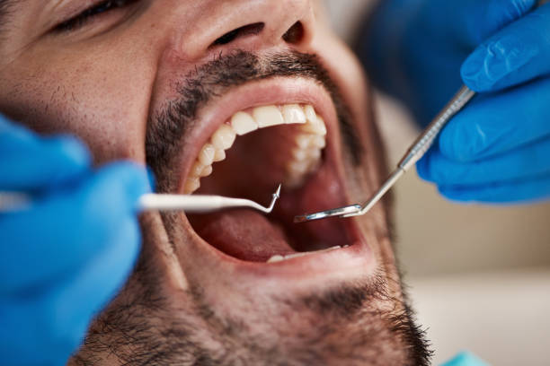 Best Dentist for Dental Trauma  in Springfield, TN